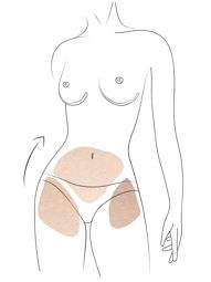 Klinika višnjar - bodylifting