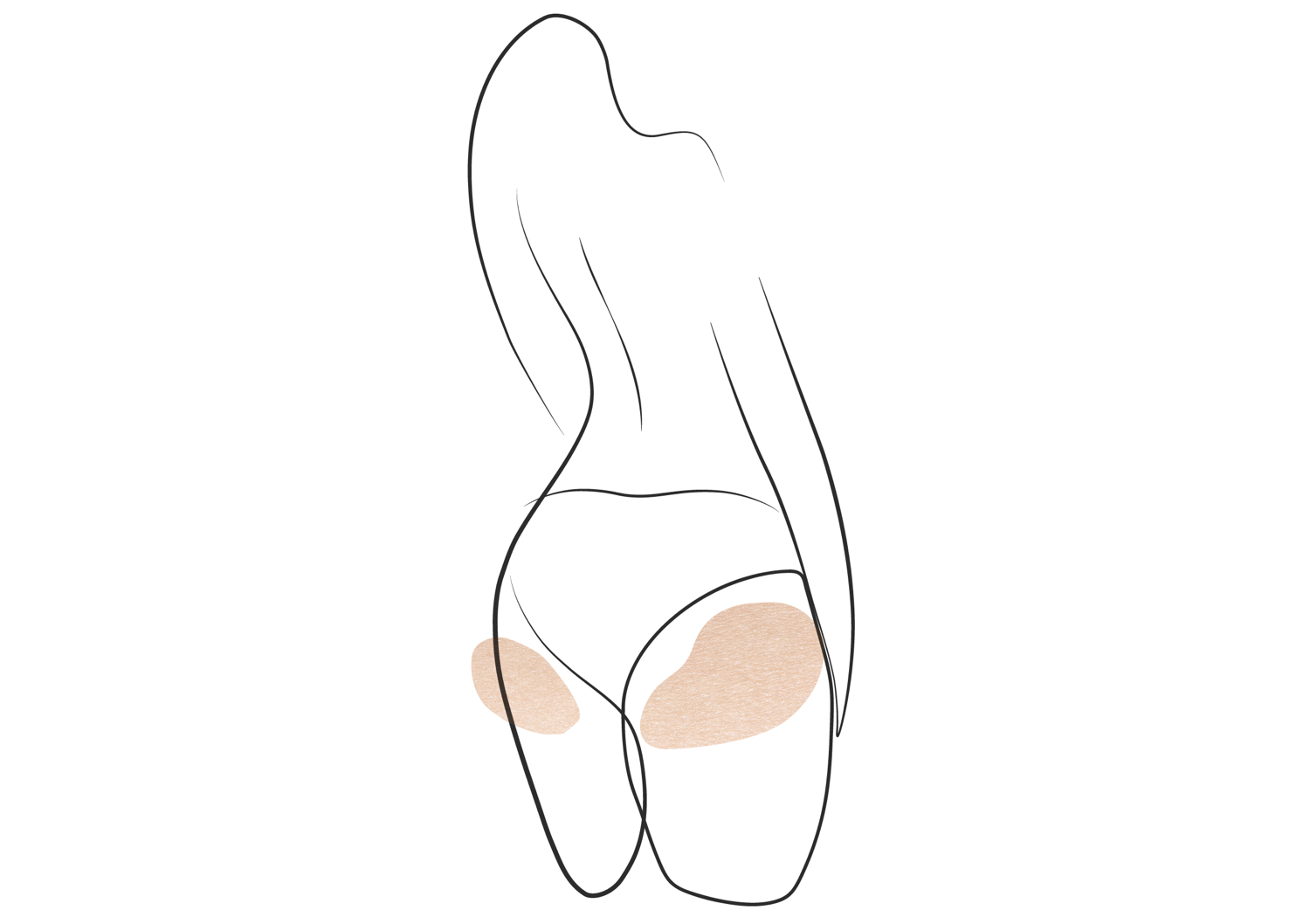 Klinika višnjar - brazilski dvig zadnjice