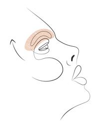 Klinika višnjar - dvig obrvi