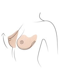 Klinika višnjar - dvig prsi