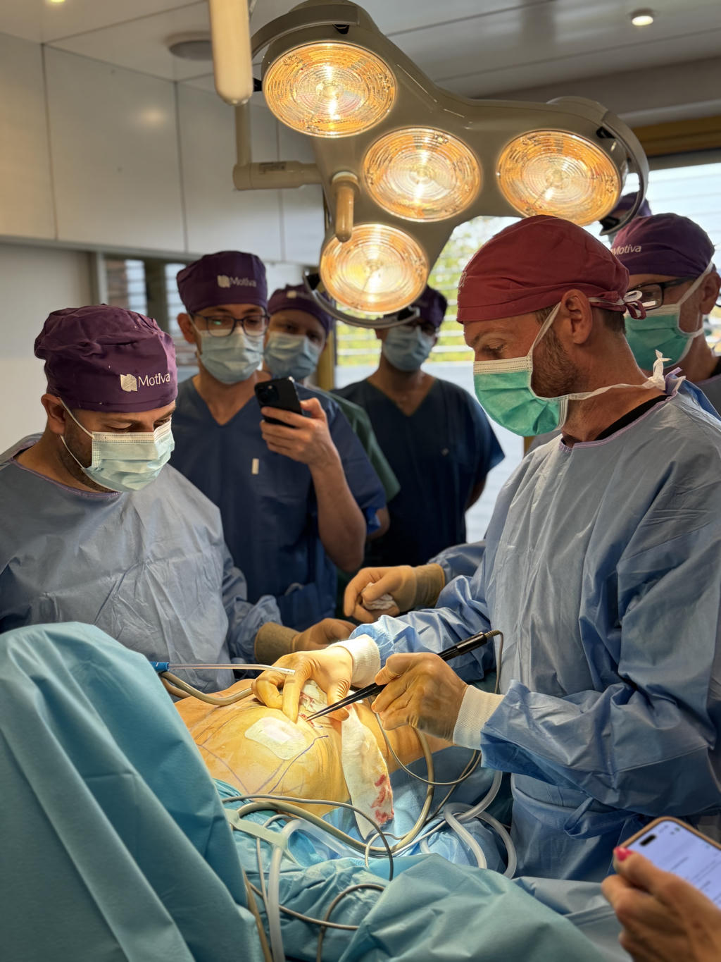 Več kirurgov in opazovalcev spremlja kirurški poseg, medtem ko glavni kirurg izvaja poseg pod svetlobo operacijske luči.