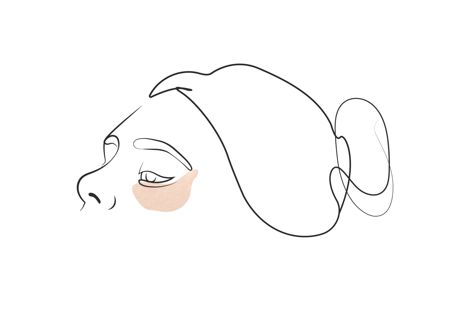 Klinika višnjar - korekcija spodnjih vek