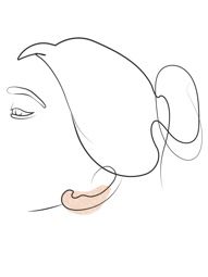 Klinika Višnjar - Korekcija ušes