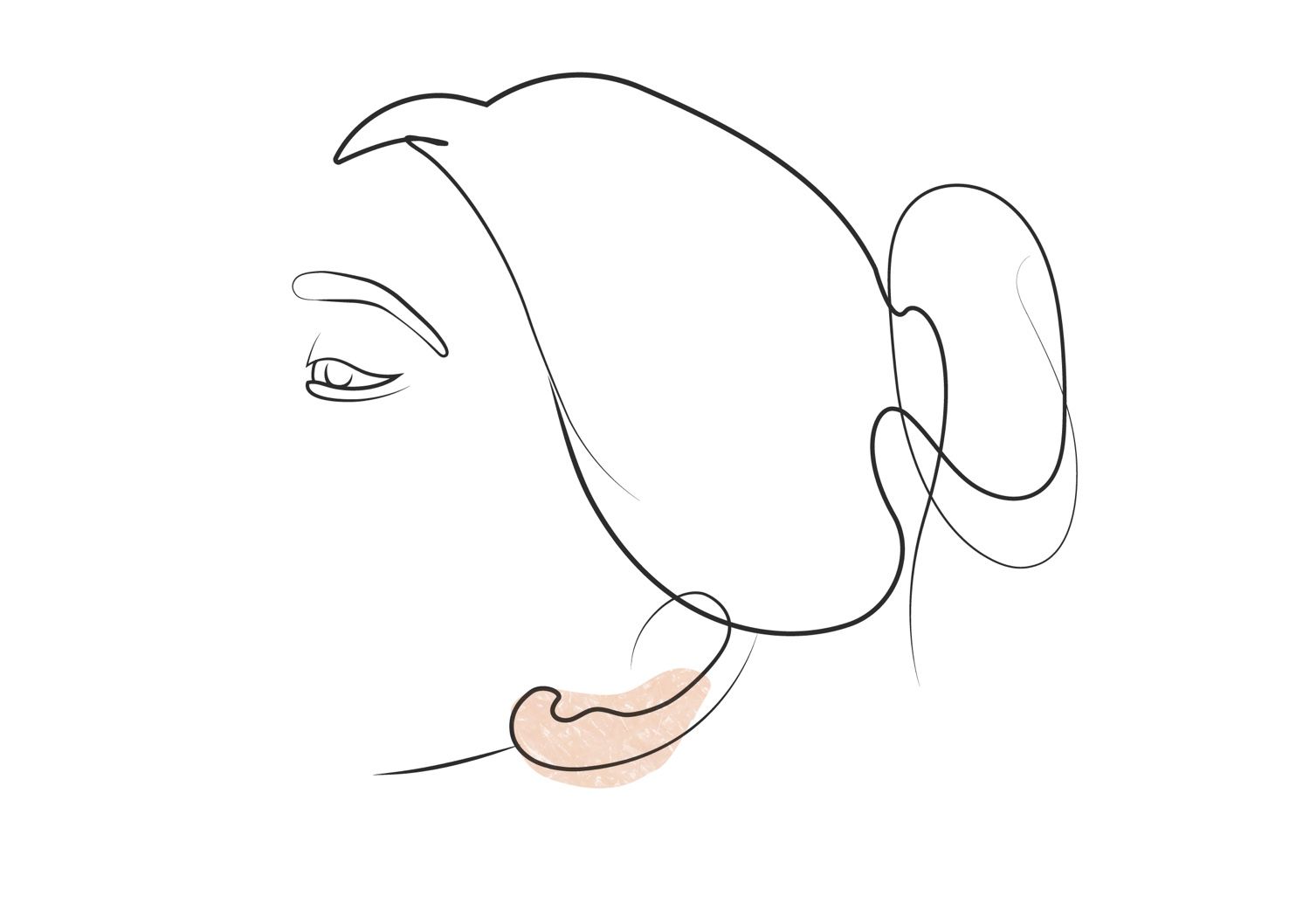 Klinika višnjar - korekcija ušes