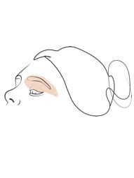 Klinika Višnjar - Korekcija zgornjih vek