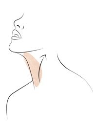 Klinika višnjar - lifting vratu