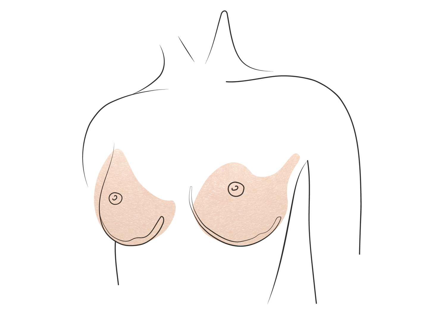Klinika višnjar - Motiva® Preservé