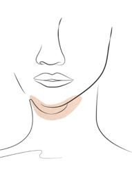 Klinika višnjar - podbradek