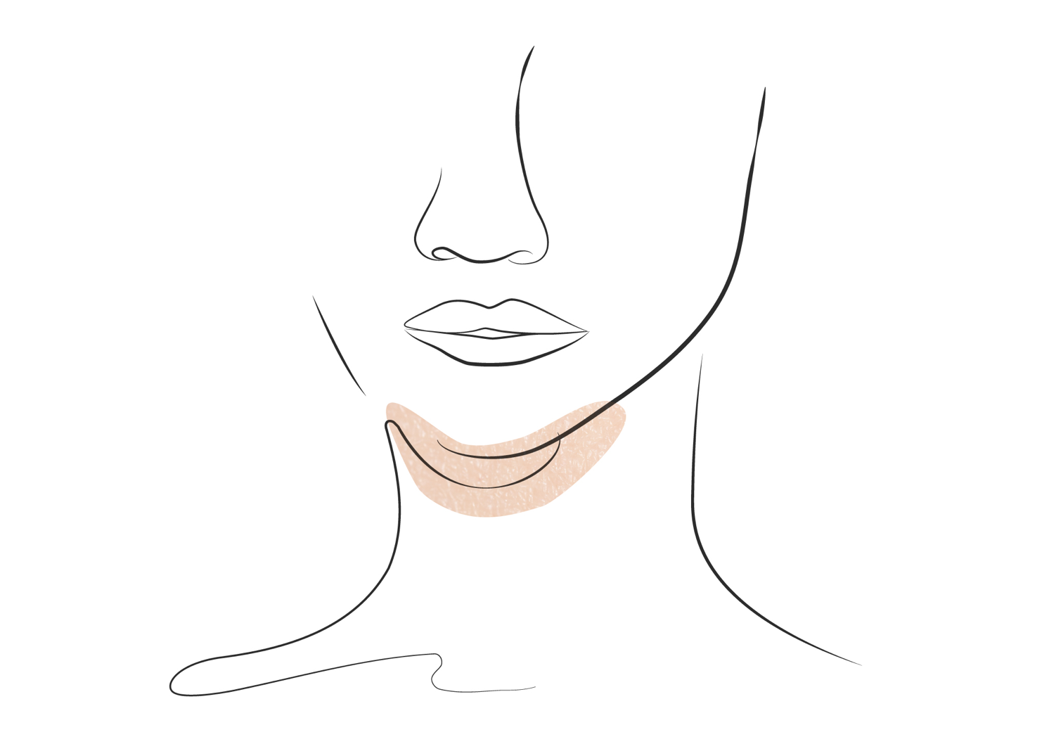 Klinika višnjar - podbradek