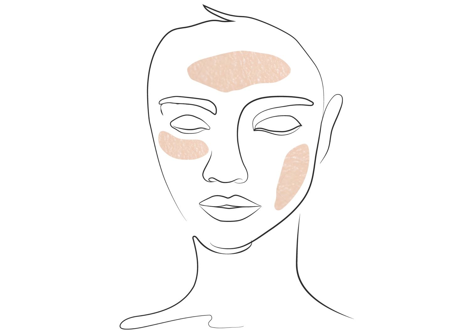 Klinika višnjar - pomlajevanje obraza