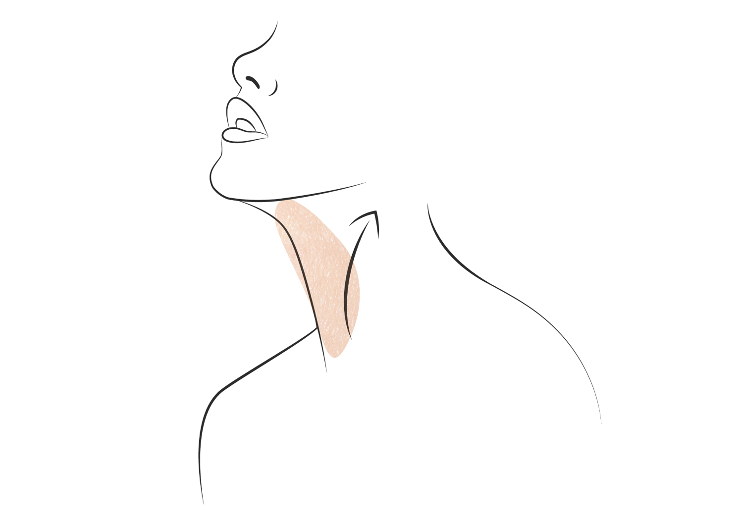 Ilustracija ženske strani vratu s poudarjeno mišico sternokleidomastoid, prikazano v svetlo rjavi barvi.