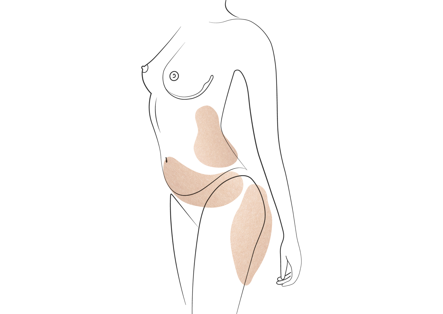 Klinika višnjar - Renuvion - učvrstitev odvečne kože brez izrezovanja