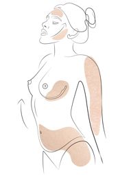 Klinika višnjar - Renuvion - učvrstitev odvečne kože brez izrezovanja