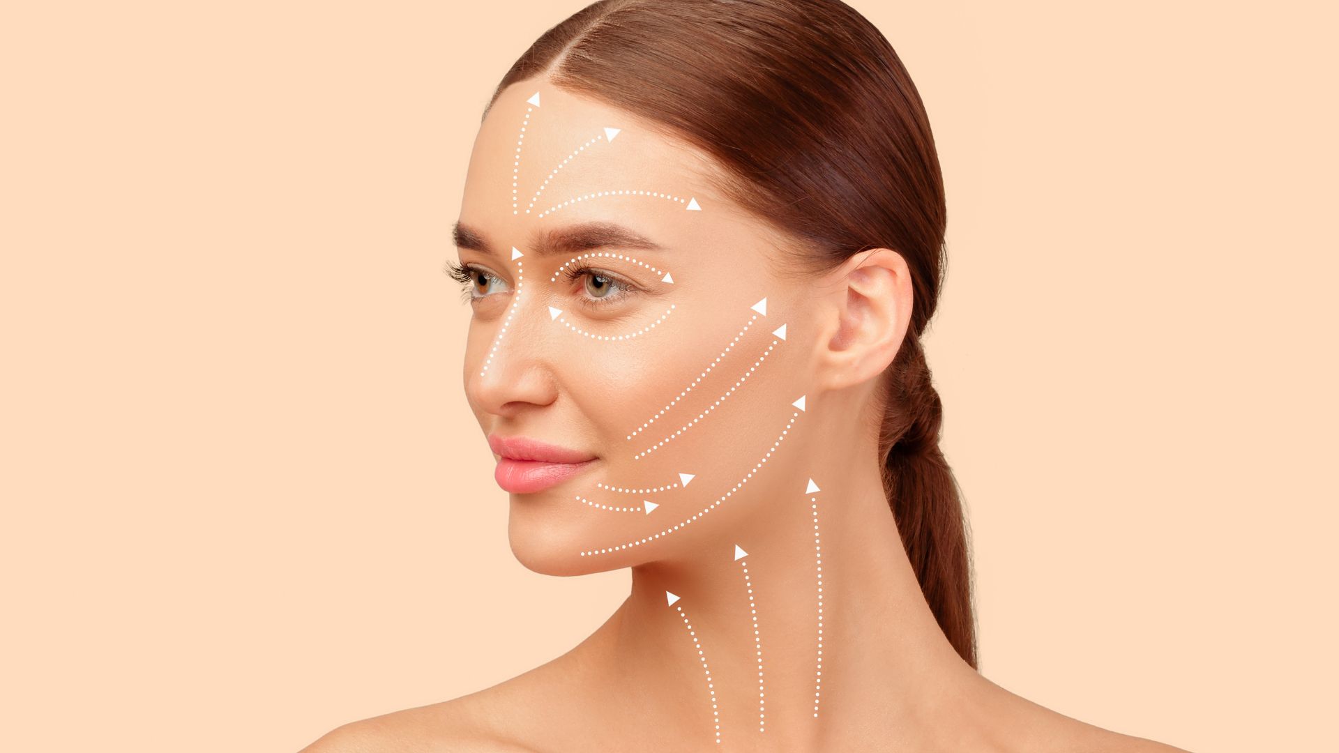 Vodnik pred facelift operacijo